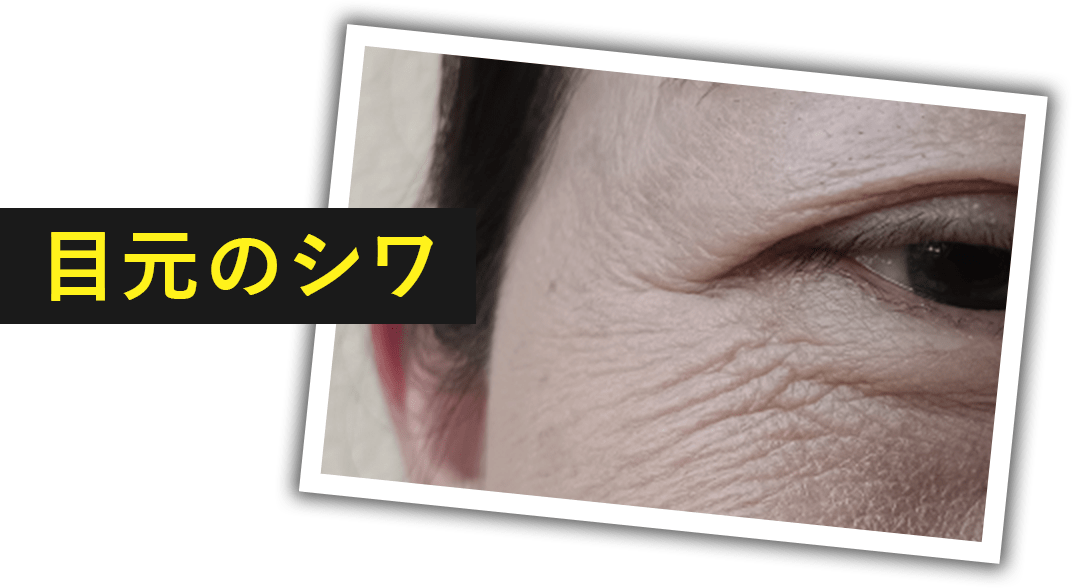 目元のシワ