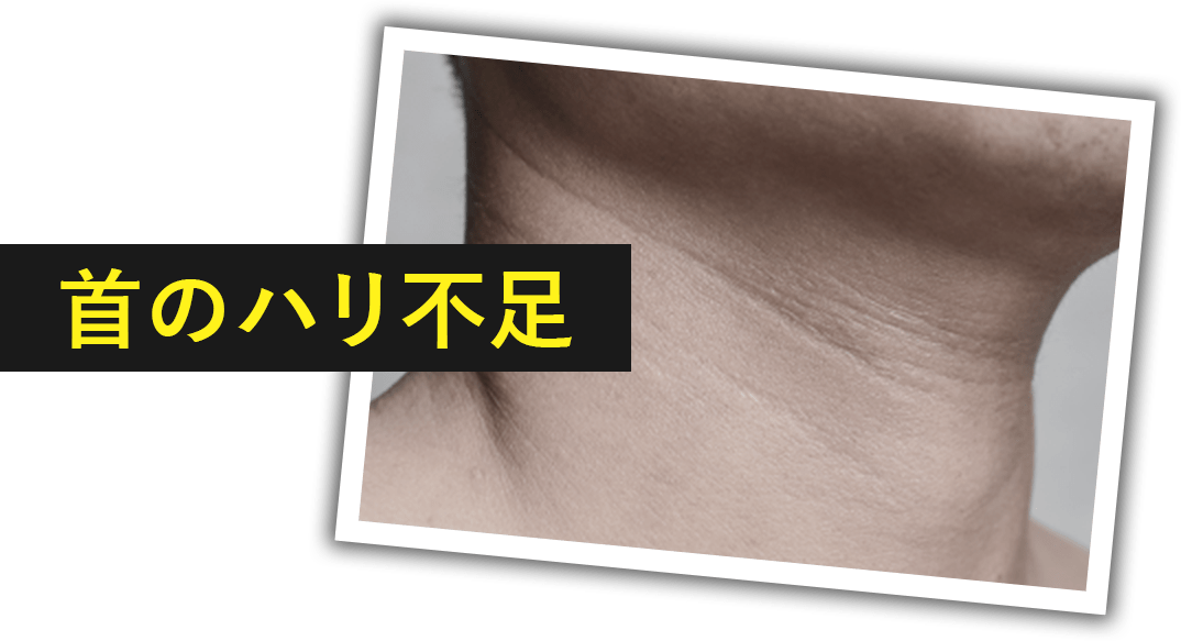 首のハリ不足